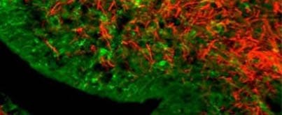 Fluorescent microscope image showing a dense network of red and green fibers, representing stained cells or tissues. The colors highlight different cellular structures against a dark background.