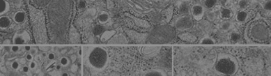 Microscopic grayscale image showing various round and oval cell structures and organelles, with detailed textures and patterns; the image is divided into two sections by a horizontal line.