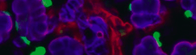 Microscopic image showing clusters of blue and purple cells with bright green spots and a network of red structures against a dark background.