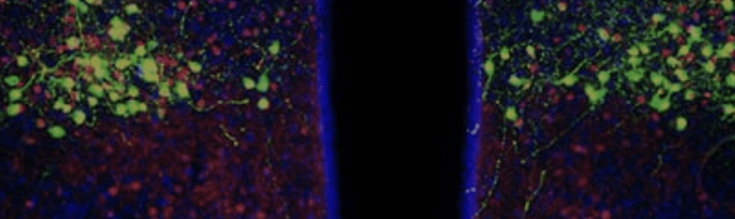 Fluorescent microscopy image shows neurons in green, red, and blue clustered on either side of a dark, central gap, illustrating neural tissue or brain cells separated by a visible divide.
