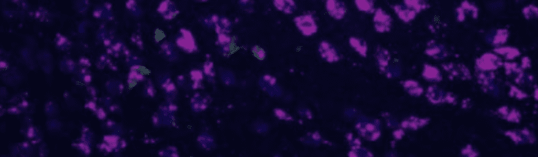 A dark microscopic image showing clusters of bright magenta and a few green spots scattered across a deep blue background.