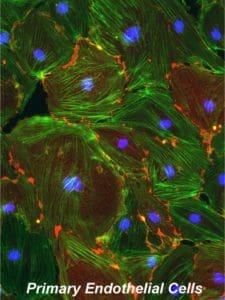 Fluorescent micrograph of primary endothelial cells; green filaments show cytoskeleton structure, blue circles indicate cell nuclei, and small red areas highlight additional cellular components. Text reads Primary Endothelial Cells.
