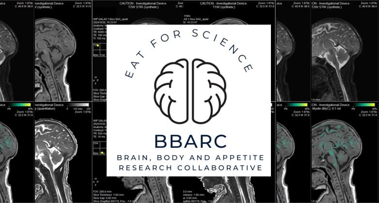 A logo for the Brain, Body and Appetite Research Collaborative (BBARC) featuring a brain illustration and the slogan Eat For Science, overlaid on MRI brain scan images.